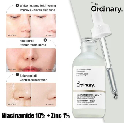 The Ordinary Skin Brightening Niacinamide 10% + Zinc 1% Serum 30ml